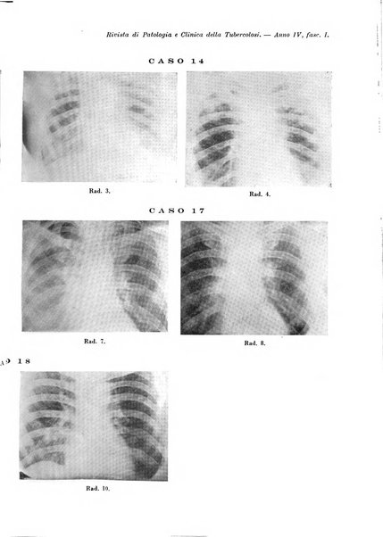 Rivista di patologia e clinica della tubercolosi organo ufficiale della Società italiana fascista di studi scientifici sulla tubercolosi