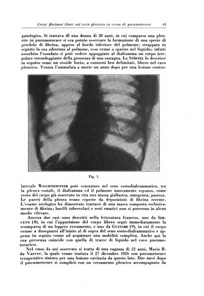 Rivista di patologia e clinica della tubercolosi organo ufficiale della Società italiana fascista di studi scientifici sulla tubercolosi