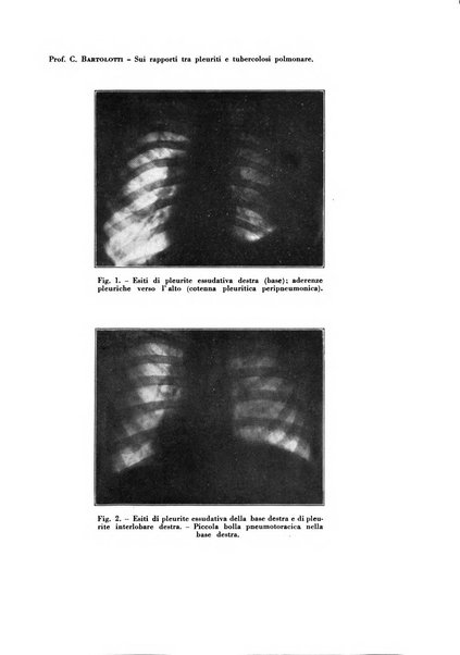 Rivista di patologia e clinica della tubercolosi organo ufficiale della Società italiana fascista di studi scientifici sulla tubercolosi