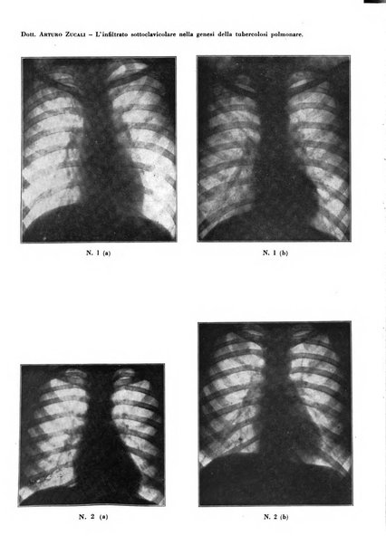 Rivista di patologia e clinica della tubercolosi organo ufficiale della Società italiana fascista di studi scientifici sulla tubercolosi