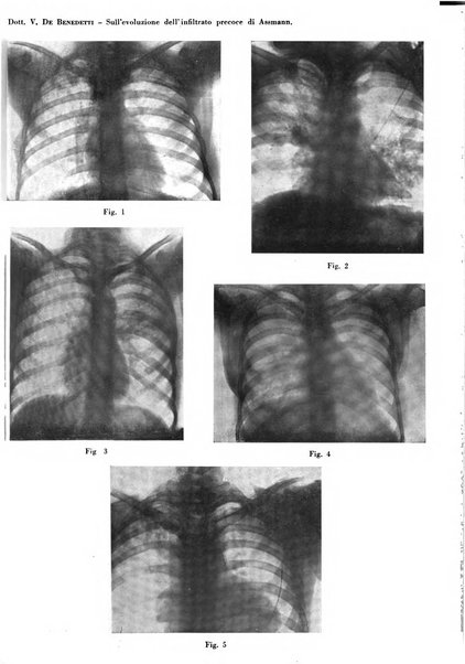 Rivista di patologia e clinica della tubercolosi organo ufficiale della Società italiana fascista di studi scientifici sulla tubercolosi