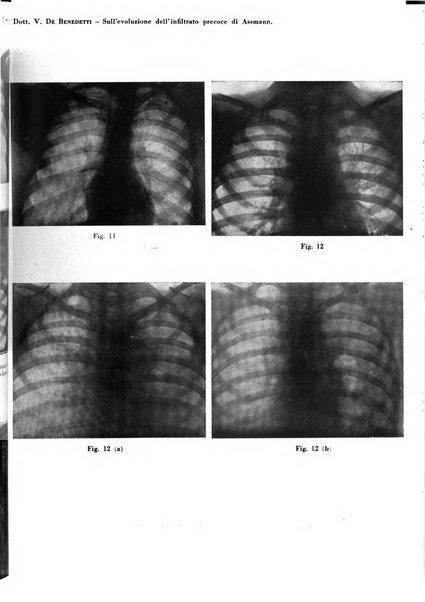 Rivista di patologia e clinica della tubercolosi organo ufficiale della Società italiana fascista di studi scientifici sulla tubercolosi