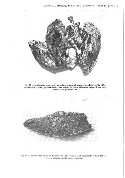 Rivista di patologia e clinica della tubercolosi organo ufficiale della Società italiana fascista di studi scientifici sulla tubercolosi