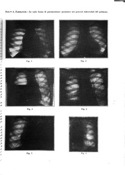 Rivista di patologia e clinica della tubercolosi organo ufficiale della Società italiana fascista di studi scientifici sulla tubercolosi