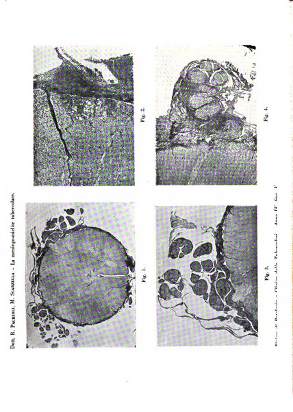 Rivista di patologia e clinica della tubercolosi organo ufficiale della Società italiana fascista di studi scientifici sulla tubercolosi