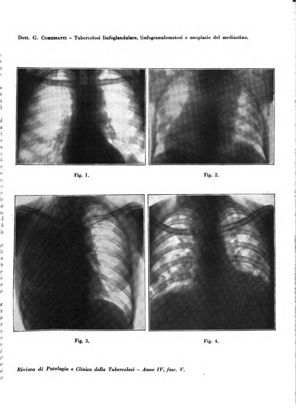 Rivista di patologia e clinica della tubercolosi organo ufficiale della Società italiana fascista di studi scientifici sulla tubercolosi