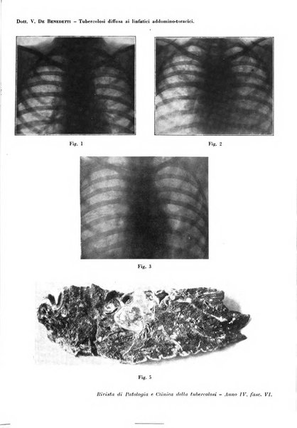 Rivista di patologia e clinica della tubercolosi organo ufficiale della Società italiana fascista di studi scientifici sulla tubercolosi