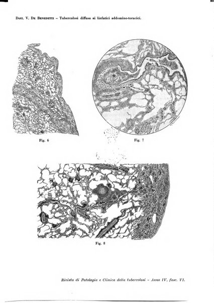 Rivista di patologia e clinica della tubercolosi organo ufficiale della Società italiana fascista di studi scientifici sulla tubercolosi