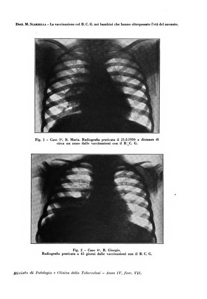 Rivista di patologia e clinica della tubercolosi organo ufficiale della Società italiana fascista di studi scientifici sulla tubercolosi