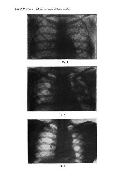 Rivista di patologia e clinica della tubercolosi organo ufficiale della Società italiana fascista di studi scientifici sulla tubercolosi