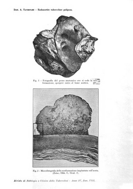 Rivista di patologia e clinica della tubercolosi organo ufficiale della Società italiana fascista di studi scientifici sulla tubercolosi