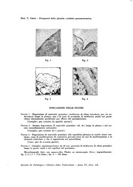 Rivista di patologia e clinica della tubercolosi organo ufficiale della Società italiana fascista di studi scientifici sulla tubercolosi