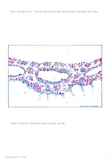 Rivista di patologia e clinica della tubercolosi organo ufficiale della Società italiana fascista di studi scientifici sulla tubercolosi