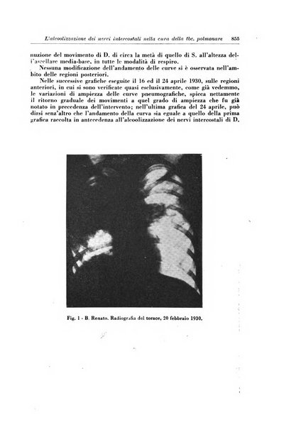 Rivista di patologia e clinica della tubercolosi organo ufficiale della Società italiana fascista di studi scientifici sulla tubercolosi