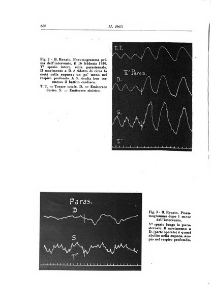 Rivista di patologia e clinica della tubercolosi organo ufficiale della Società italiana fascista di studi scientifici sulla tubercolosi