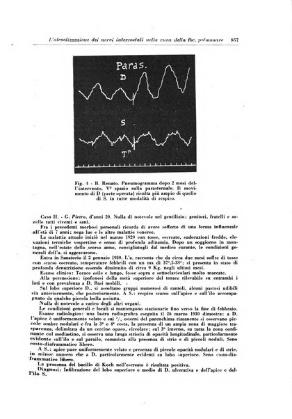 Rivista di patologia e clinica della tubercolosi organo ufficiale della Società italiana fascista di studi scientifici sulla tubercolosi