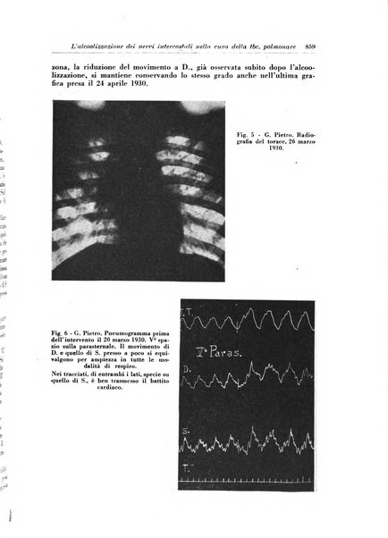 Rivista di patologia e clinica della tubercolosi organo ufficiale della Società italiana fascista di studi scientifici sulla tubercolosi