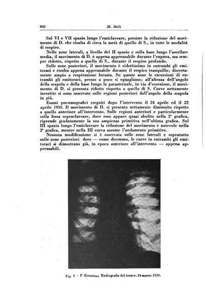 Rivista di patologia e clinica della tubercolosi organo ufficiale della Società italiana fascista di studi scientifici sulla tubercolosi