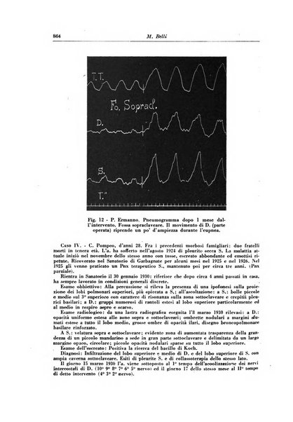 Rivista di patologia e clinica della tubercolosi organo ufficiale della Società italiana fascista di studi scientifici sulla tubercolosi