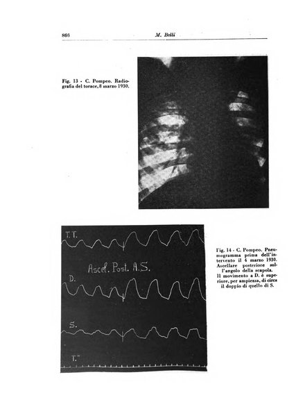 Rivista di patologia e clinica della tubercolosi organo ufficiale della Società italiana fascista di studi scientifici sulla tubercolosi