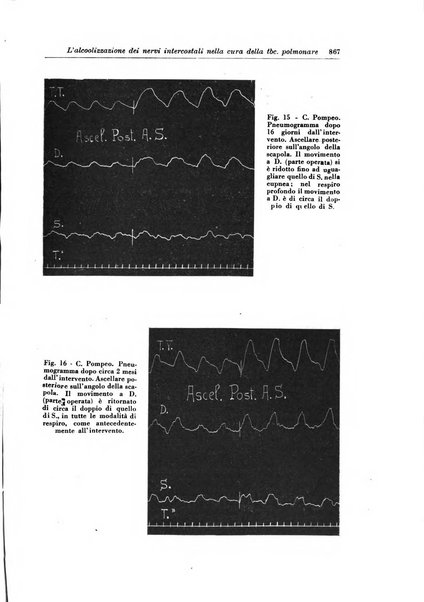 Rivista di patologia e clinica della tubercolosi organo ufficiale della Società italiana fascista di studi scientifici sulla tubercolosi