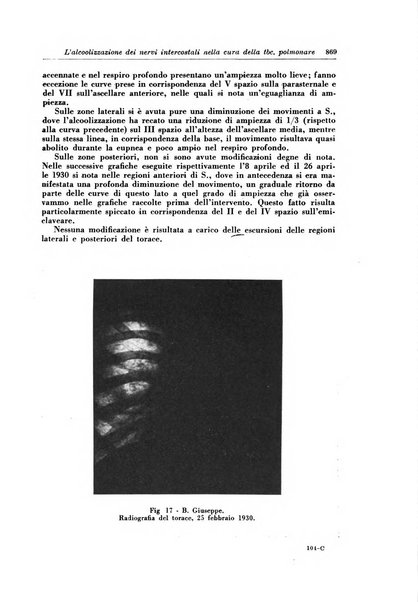 Rivista di patologia e clinica della tubercolosi organo ufficiale della Società italiana fascista di studi scientifici sulla tubercolosi