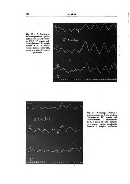 Rivista di patologia e clinica della tubercolosi organo ufficiale della Società italiana fascista di studi scientifici sulla tubercolosi