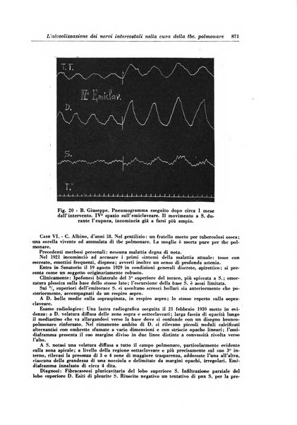 Rivista di patologia e clinica della tubercolosi organo ufficiale della Società italiana fascista di studi scientifici sulla tubercolosi