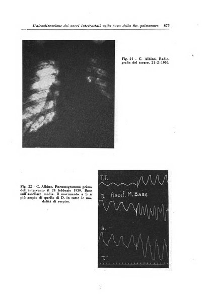 Rivista di patologia e clinica della tubercolosi organo ufficiale della Società italiana fascista di studi scientifici sulla tubercolosi