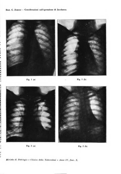 Rivista di patologia e clinica della tubercolosi organo ufficiale della Società italiana fascista di studi scientifici sulla tubercolosi