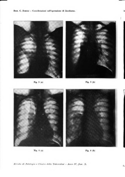 Rivista di patologia e clinica della tubercolosi organo ufficiale della Società italiana fascista di studi scientifici sulla tubercolosi