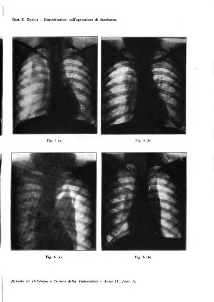 Rivista di patologia e clinica della tubercolosi organo ufficiale della Società italiana fascista di studi scientifici sulla tubercolosi