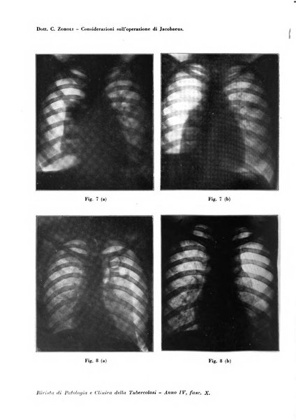 Rivista di patologia e clinica della tubercolosi organo ufficiale della Società italiana fascista di studi scientifici sulla tubercolosi