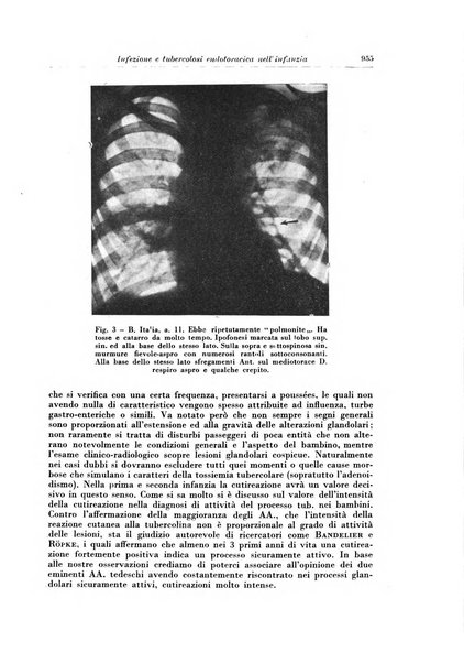 Rivista di patologia e clinica della tubercolosi organo ufficiale della Società italiana fascista di studi scientifici sulla tubercolosi