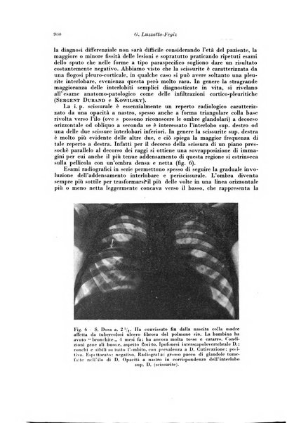 Rivista di patologia e clinica della tubercolosi organo ufficiale della Società italiana fascista di studi scientifici sulla tubercolosi