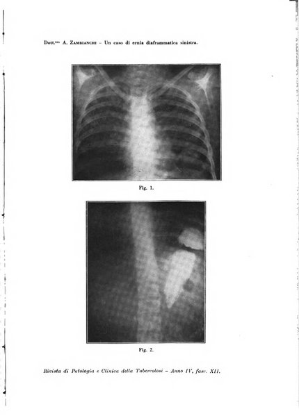 Rivista di patologia e clinica della tubercolosi organo ufficiale della Società italiana fascista di studi scientifici sulla tubercolosi