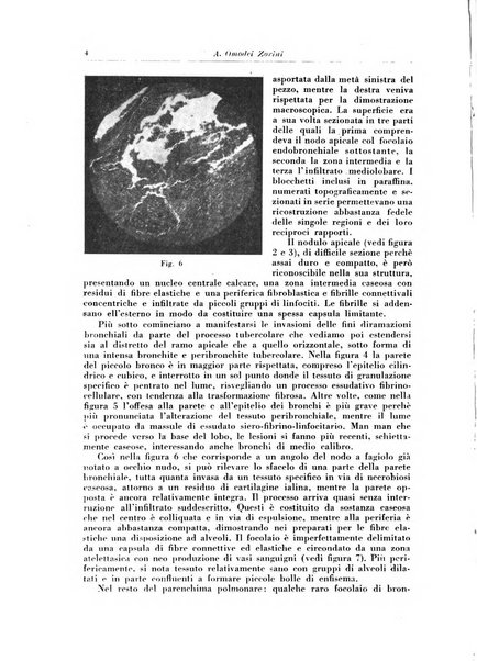 Rivista di patologia e clinica della tubercolosi organo ufficiale della Società italiana fascista di studi scientifici sulla tubercolosi