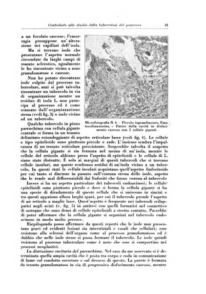 Rivista di patologia e clinica della tubercolosi organo ufficiale della Società italiana fascista di studi scientifici sulla tubercolosi