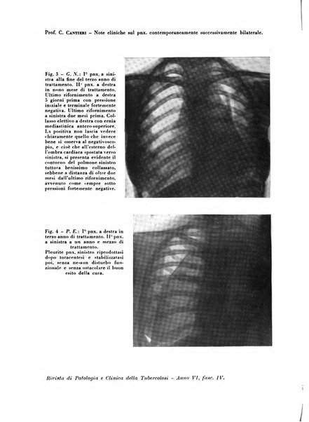 Rivista di patologia e clinica della tubercolosi organo ufficiale della Società italiana fascista di studi scientifici sulla tubercolosi