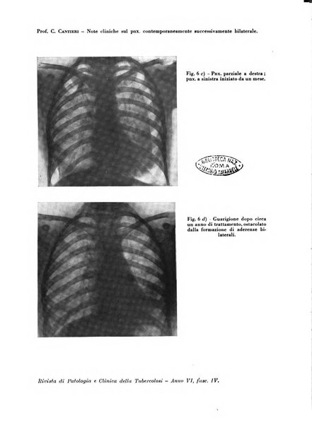 Rivista di patologia e clinica della tubercolosi organo ufficiale della Società italiana fascista di studi scientifici sulla tubercolosi