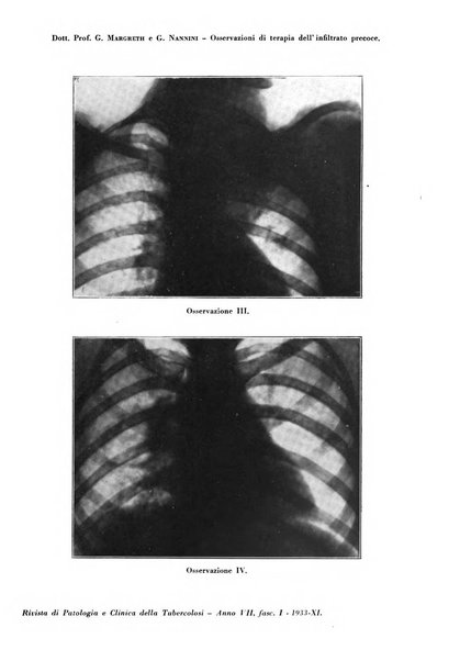 Rivista di patologia e clinica della tubercolosi organo ufficiale della Società italiana fascista di studi scientifici sulla tubercolosi