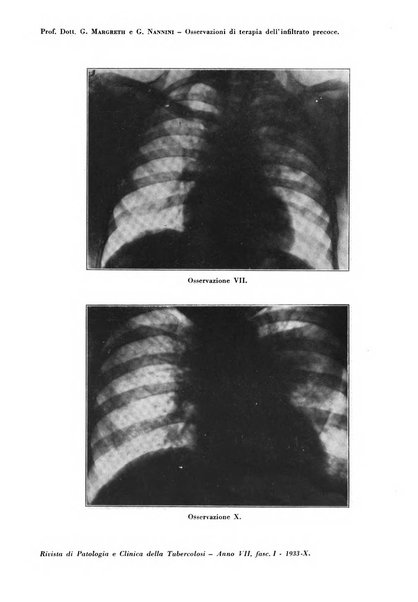 Rivista di patologia e clinica della tubercolosi organo ufficiale della Società italiana fascista di studi scientifici sulla tubercolosi