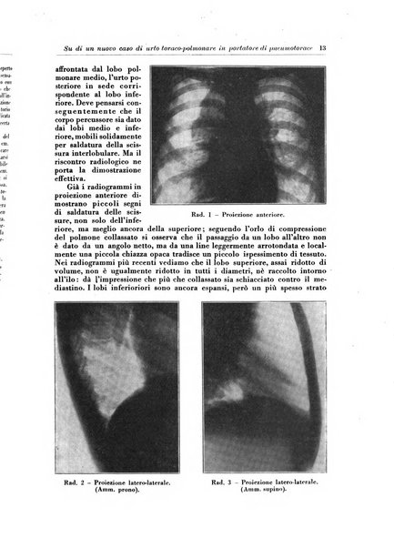 Rivista di patologia e clinica della tubercolosi organo ufficiale della Società italiana fascista di studi scientifici sulla tubercolosi