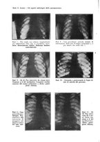 giornale/PUV0112329/1933/unico/00000058