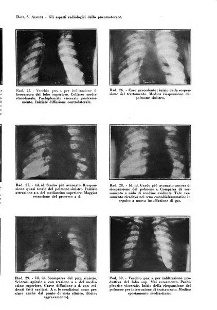 Rivista di patologia e clinica della tubercolosi organo ufficiale della Società italiana fascista di studi scientifici sulla tubercolosi