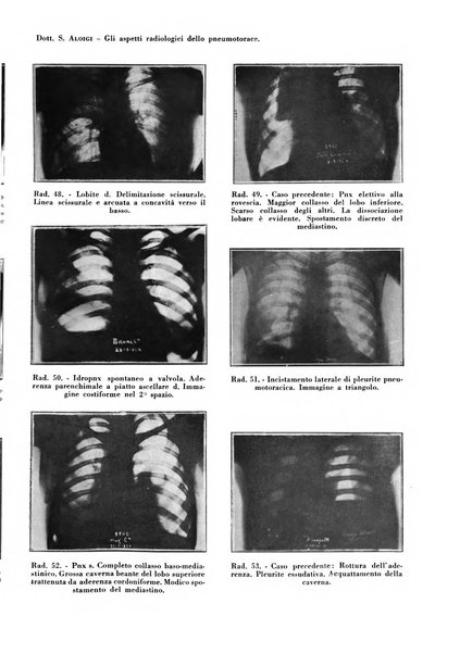 Rivista di patologia e clinica della tubercolosi organo ufficiale della Società italiana fascista di studi scientifici sulla tubercolosi