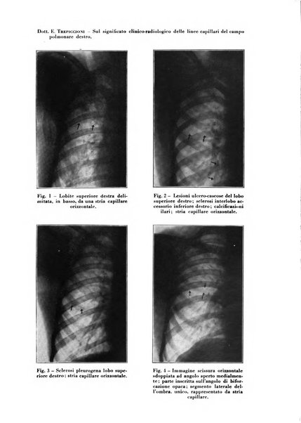 Rivista di patologia e clinica della tubercolosi organo ufficiale della Società italiana fascista di studi scientifici sulla tubercolosi