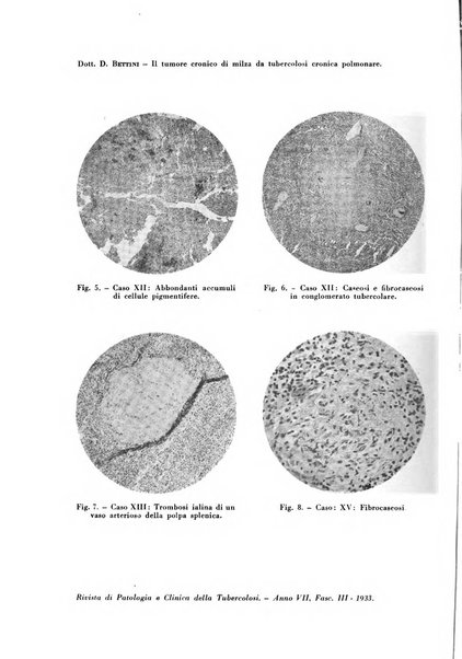 Rivista di patologia e clinica della tubercolosi organo ufficiale della Società italiana fascista di studi scientifici sulla tubercolosi