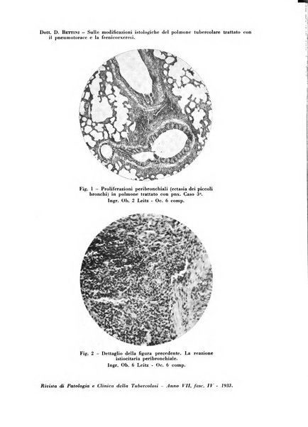 Rivista di patologia e clinica della tubercolosi organo ufficiale della Società italiana fascista di studi scientifici sulla tubercolosi