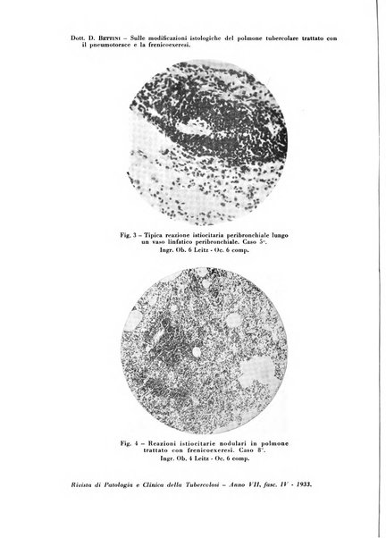 Rivista di patologia e clinica della tubercolosi organo ufficiale della Società italiana fascista di studi scientifici sulla tubercolosi